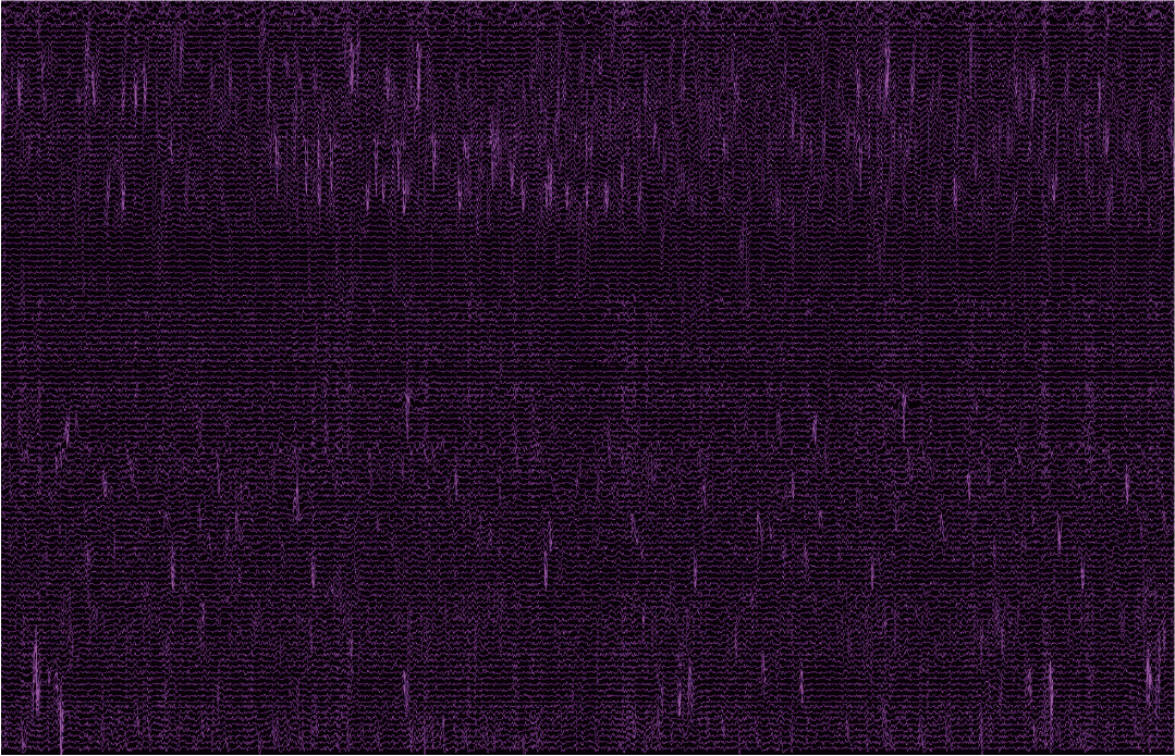 After Denoising